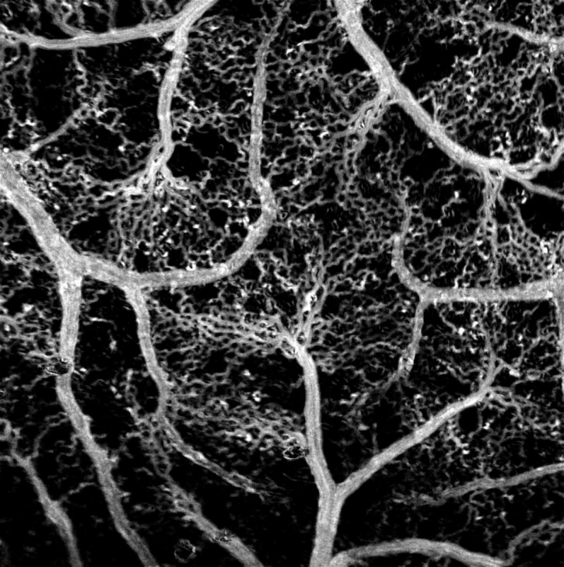 A reconstructed map of the blood vessel network in a chicken embryo obtained by adaptive frame-by-frame threshold filtering of a series of images of moving red blood cells. Credit: Maxim Kurochkin/Skoltech