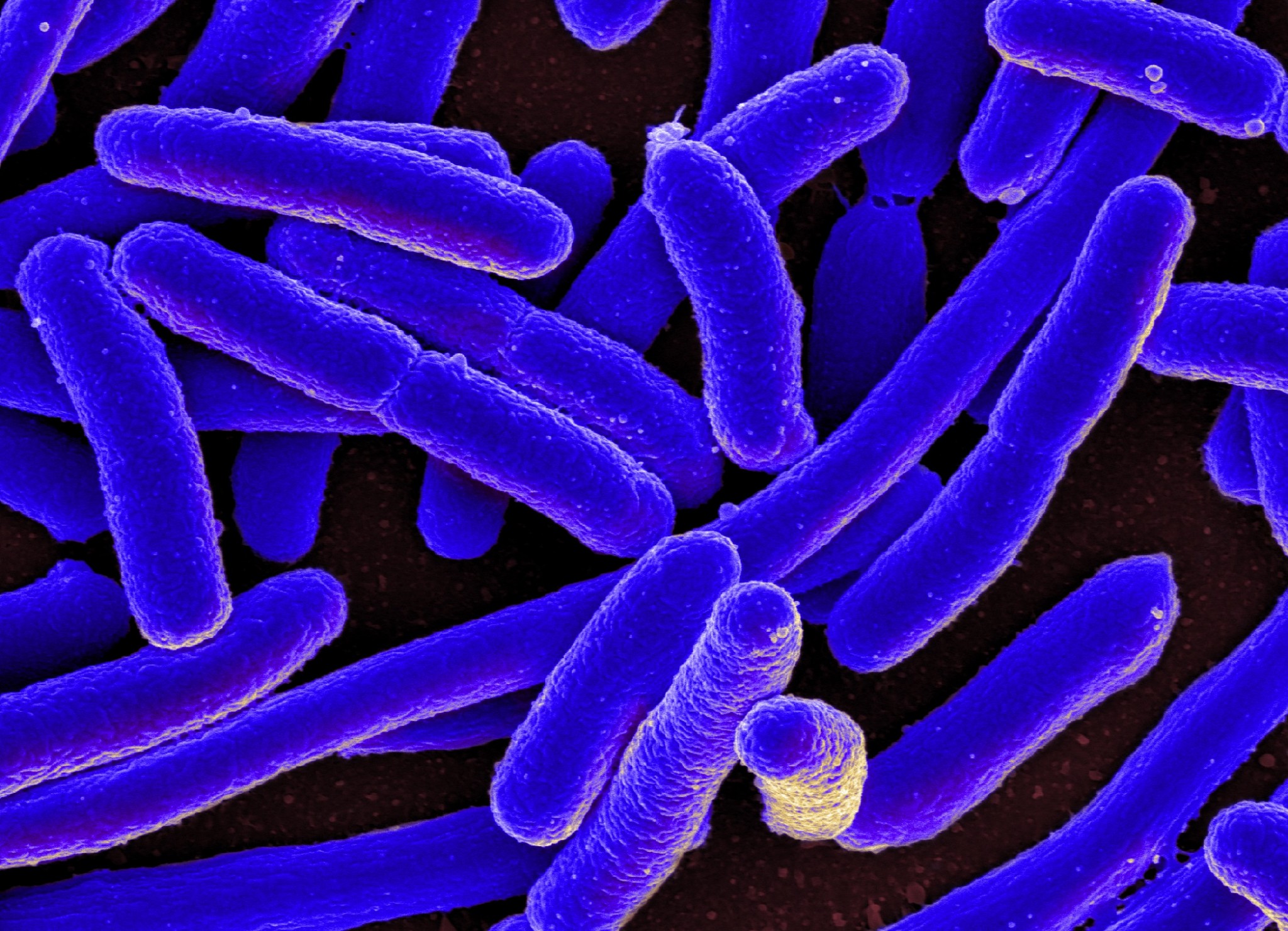 E. Coli. Image: Wikimedia Commons.