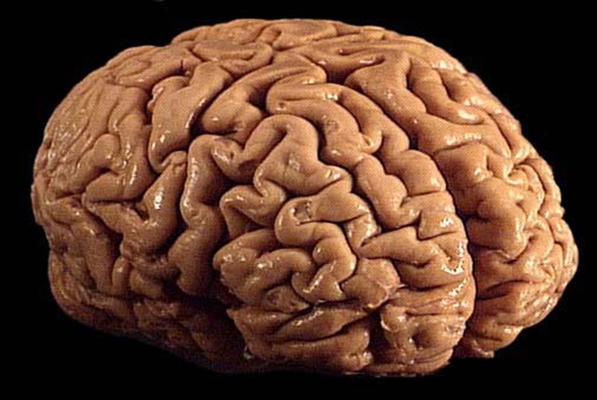 A Skoltech-led initiative is poised to change the game in brain-disorder diagnostics. Photo: By Allan Ajifo // Wikimedia Commons